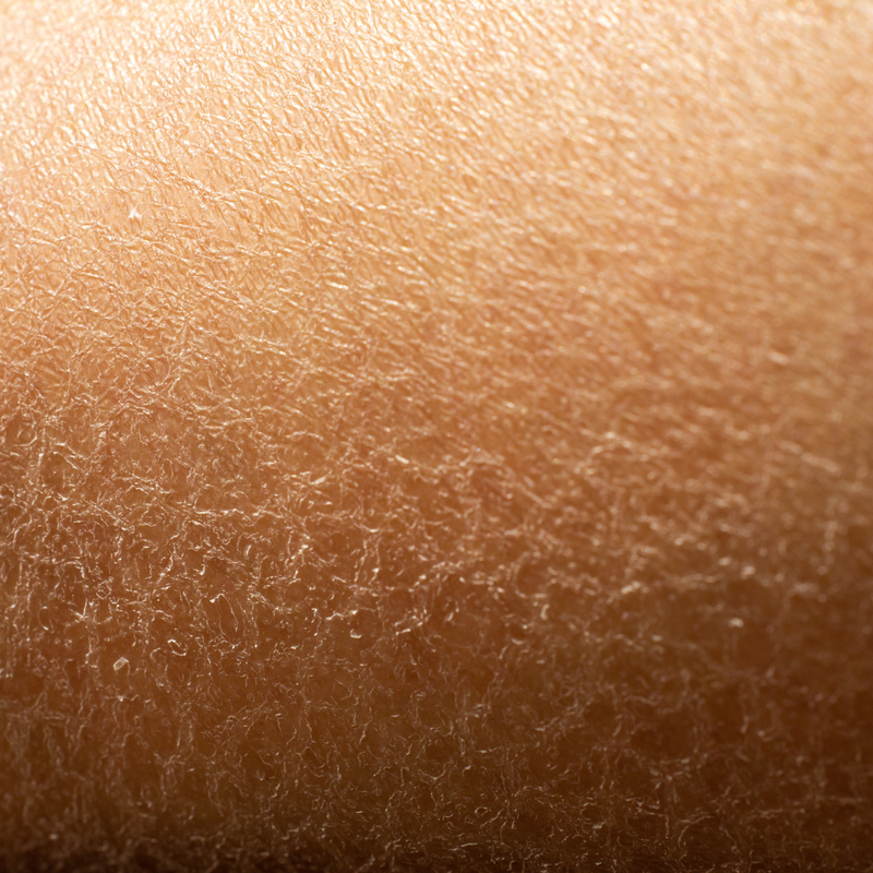 Dry Skin - Dancing Dust UK